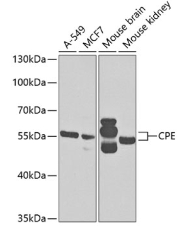 CPE Rabbit Polyclonal Antibody