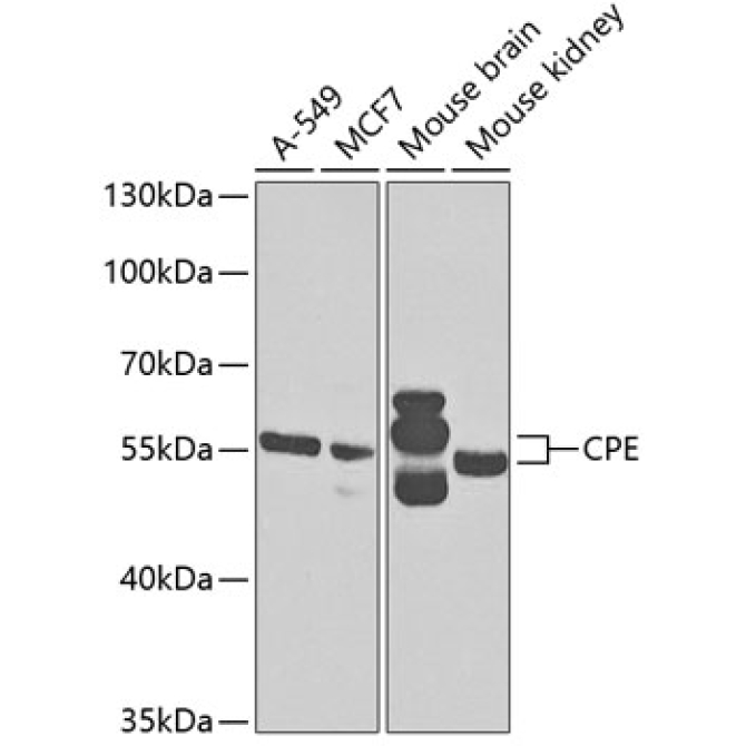 CPE Rabbit Polyclonal Antibody