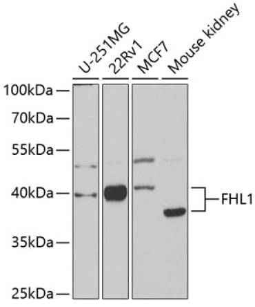 FHL1 Rabbit Polyclonal Antibody