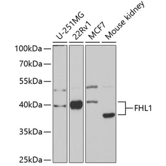 FHL1 Rabbit Polyclonal Antibody