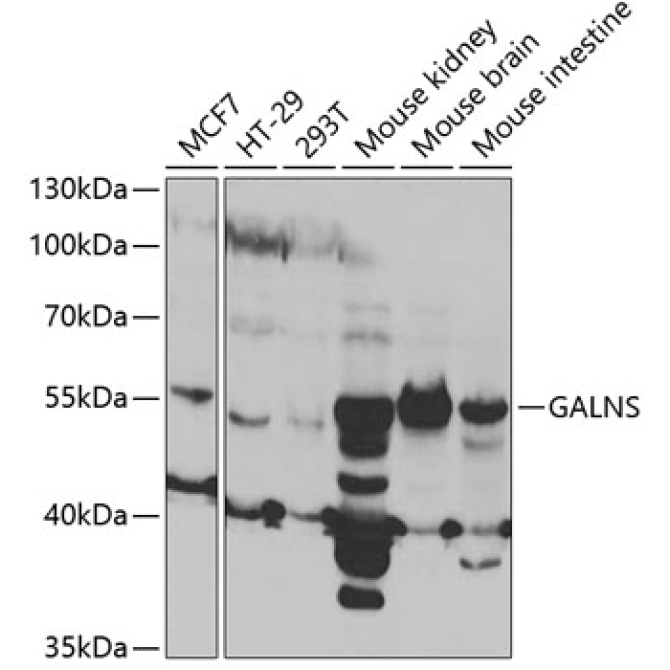 GALNS Rabbit Polyclonal Antibody