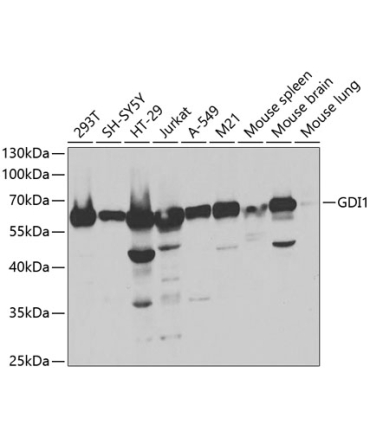 GDI1 Rabbit Polyclonal Antibody