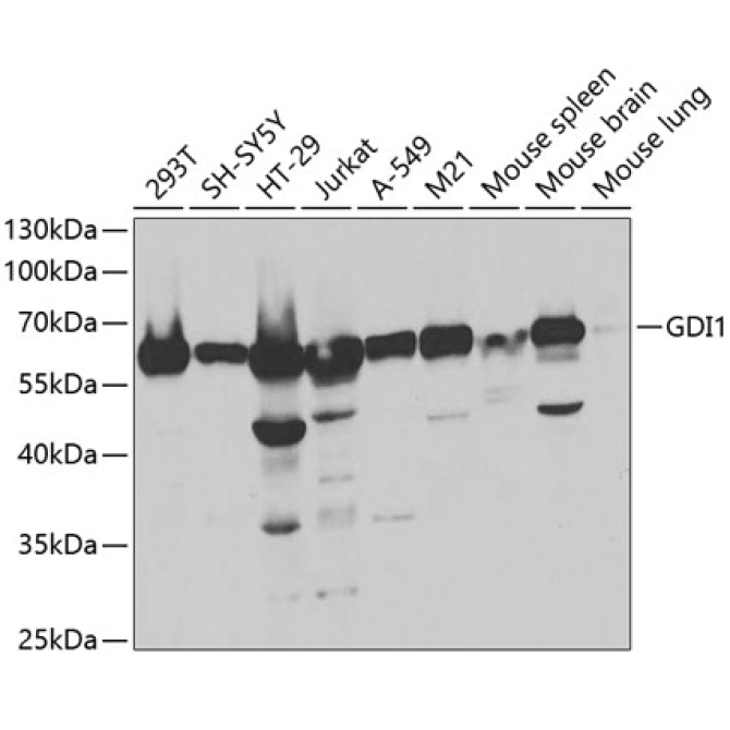 GDI1 Rabbit Polyclonal Antibody