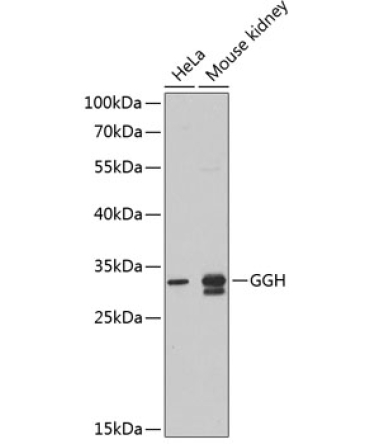 GGH Rabbit Polyclonal Antibody