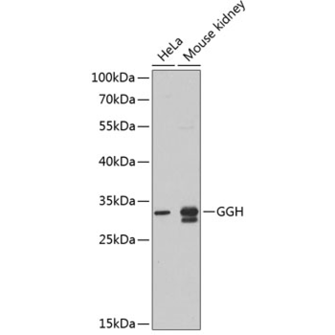 GGH Rabbit Polyclonal Antibody