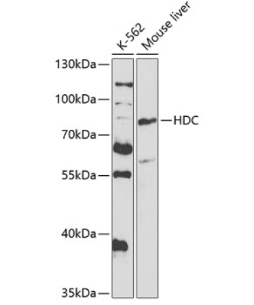 HDC Rabbit Polyclonal Antibody