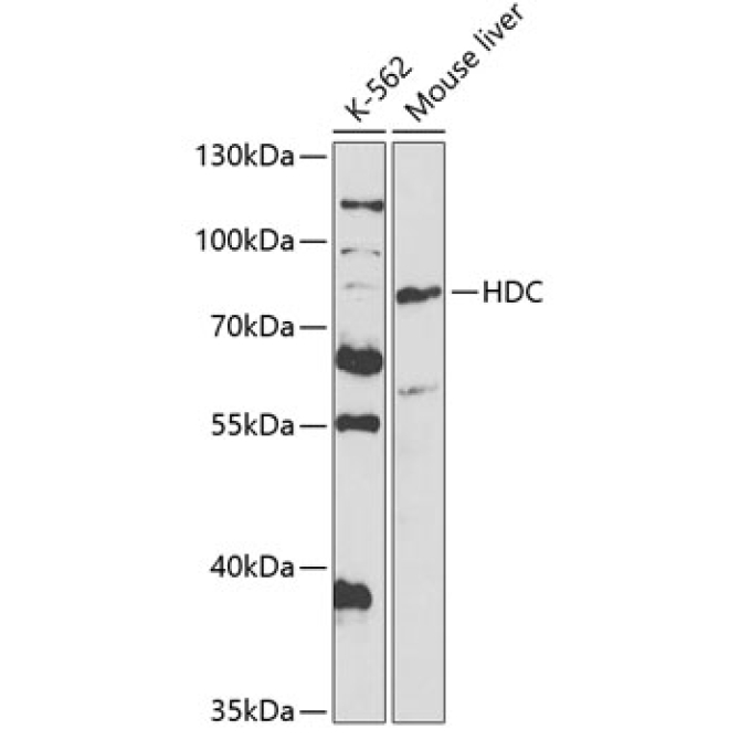 HDC Rabbit Polyclonal Antibody