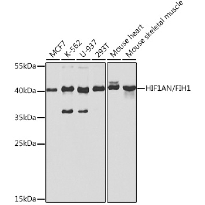 HIF1AN/FIH1 Rabbit Polyclonal Antibody [KO Validated]