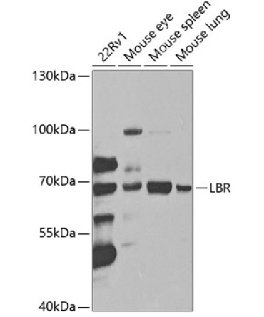 LBR Rabbit Polyclonal Antibody