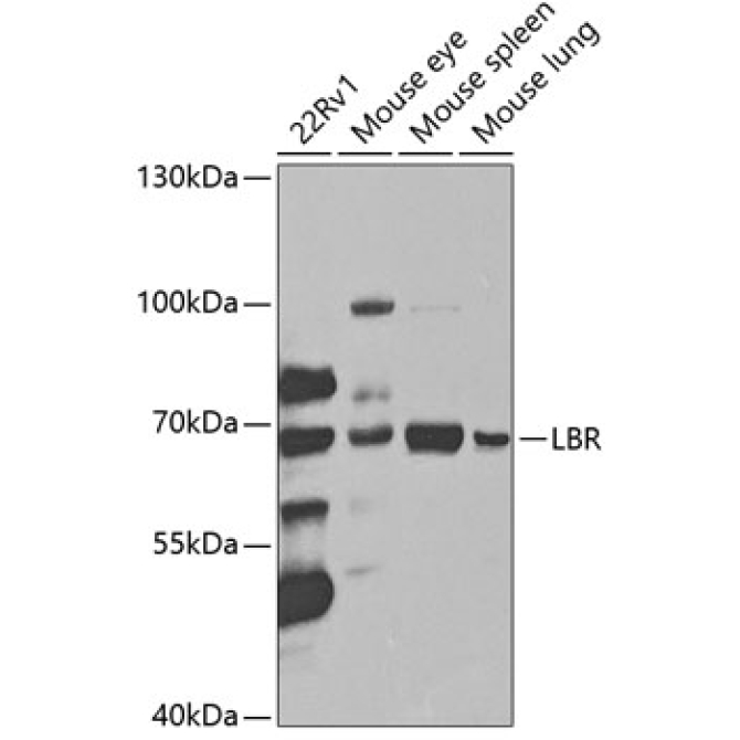 LBR Rabbit Polyclonal Antibody