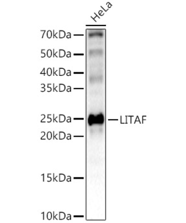 LITAF Rabbit Polyclonal Antibody [KO Validated]