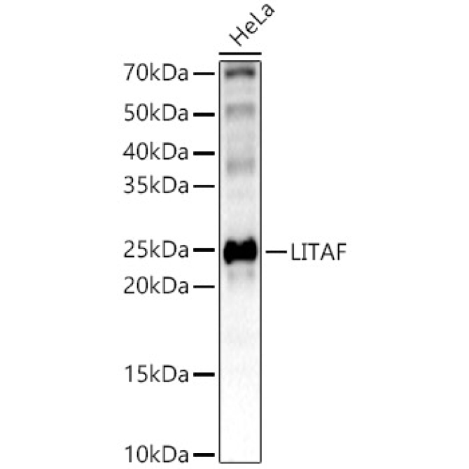LITAF Rabbit Polyclonal Antibody [KO Validated]