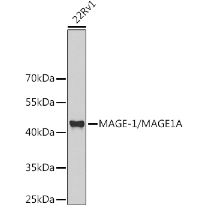 MAGE-1/MAGE1A Rabbit Polyclonal Antibody