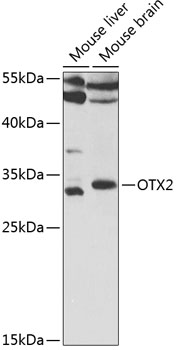 OTX2 Rabbit Polyclonal Antibody