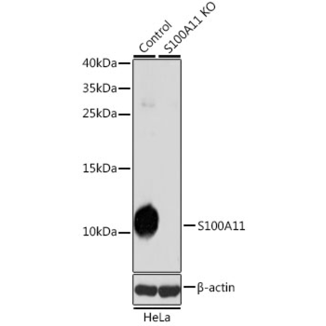 S100A11 Rabbit Polyclonal Antibody [KO Validated]
