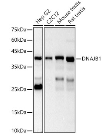 DNAJB1 Rabbit Polyclonal Antibody [KO Validated]