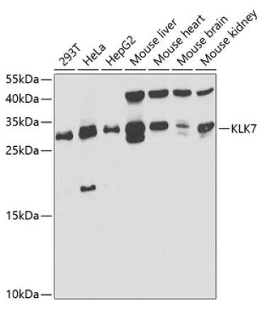 KLK7 Rabbit Polyclonal Antibody