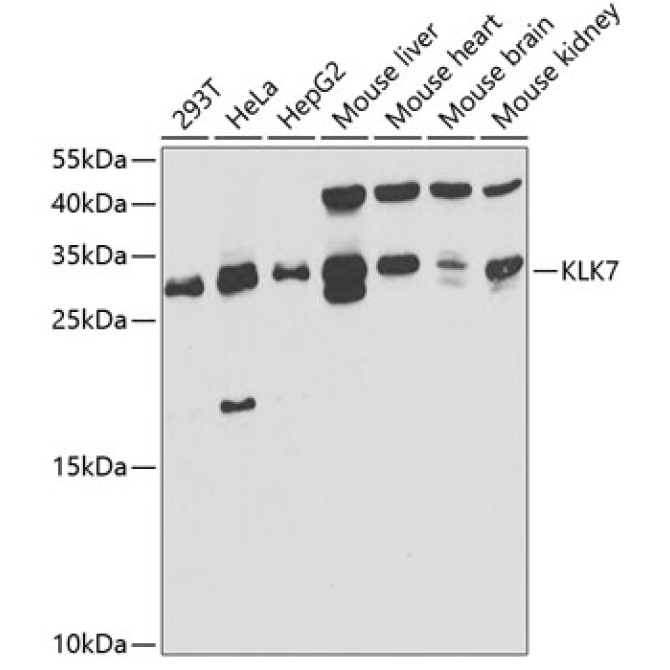 KLK7 Rabbit Polyclonal Antibody