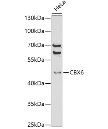 CBX6 Rabbit Polyclonal Antibody