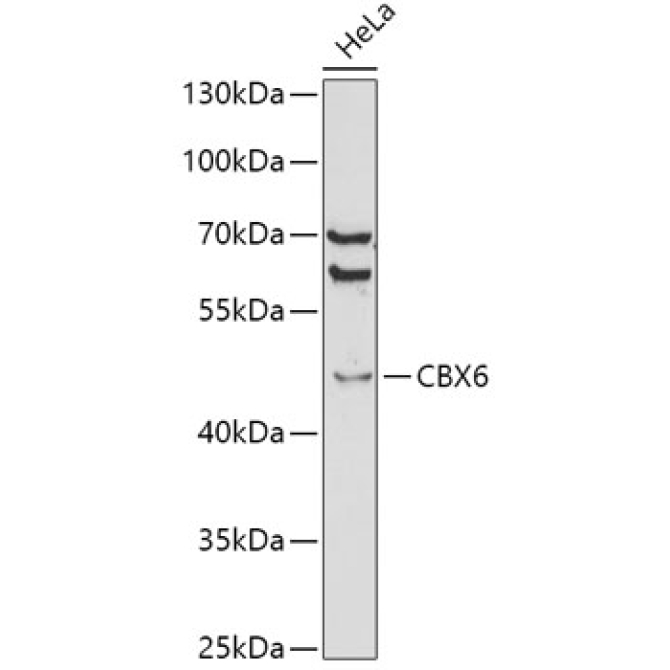 CBX6 Rabbit Polyclonal Antibody