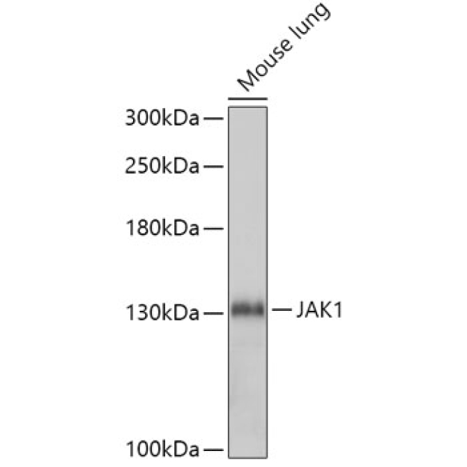 JAK1 Rabbit Polyclonal Antibody