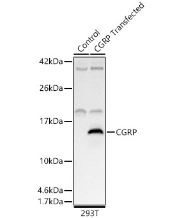 CGRP Rabbit Polyclonal Antibody