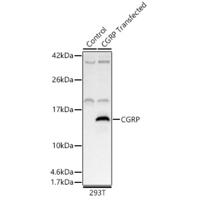 CGRP Rabbit Polyclonal Antibody