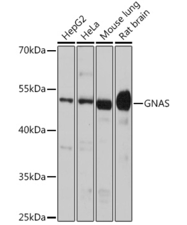 GNAS Rabbit Polyclonal Antibody