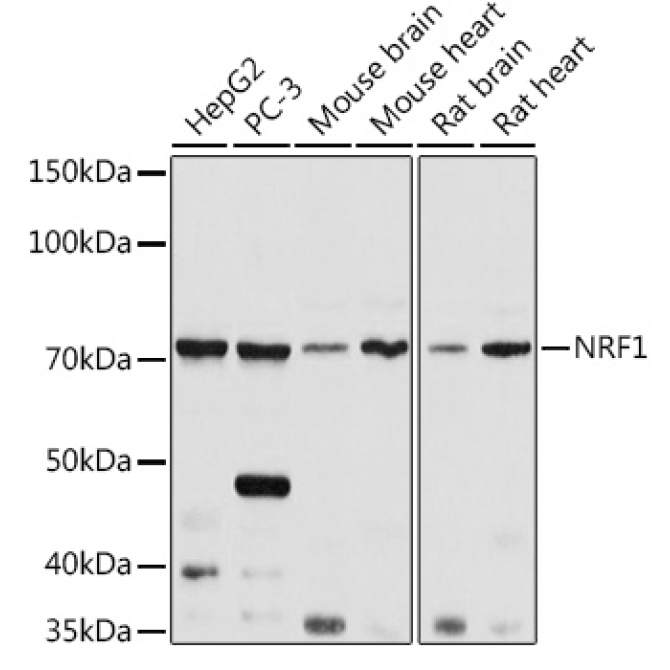 NRF1 Rabbit Polyclonal Antibody