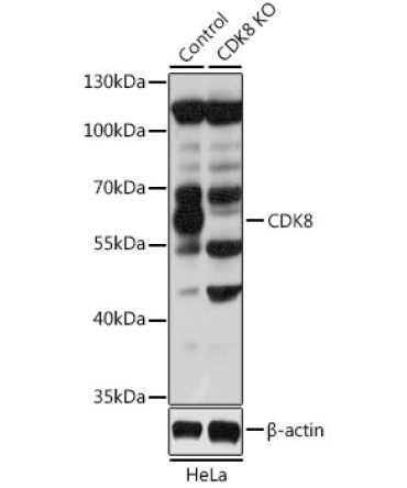 CDK8 Rabbit Polyclonal Antibody [KO Validated]