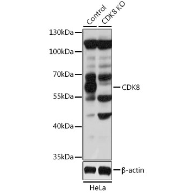 CDK8 Rabbit Polyclonal Antibody [KO Validated]