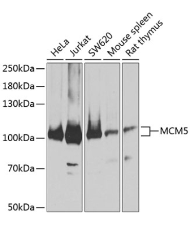 MCM5 Rabbit Polyclonal Antibody