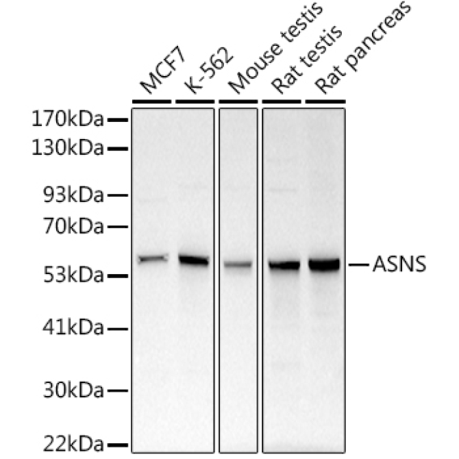 ASNS Rabbit Polyclonal Antibody