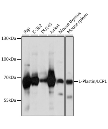 L-Plastin/LCP1 Rabbit Polyclonal Antibody