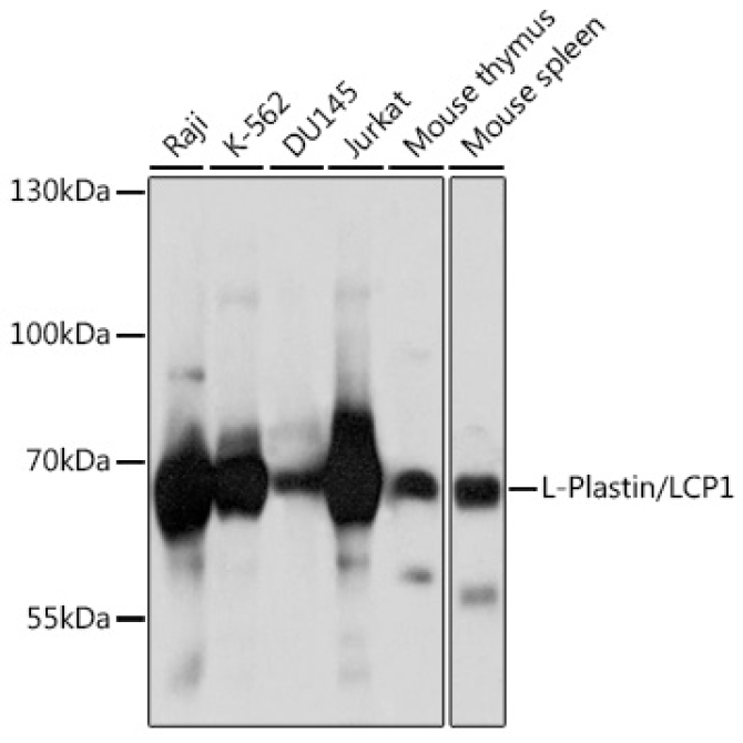 L-Plastin/LCP1 Rabbit Polyclonal Antibody