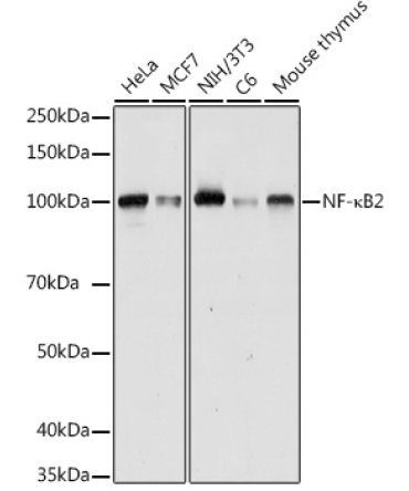 NF-?B2 Rabbit Polyclonal Antibody