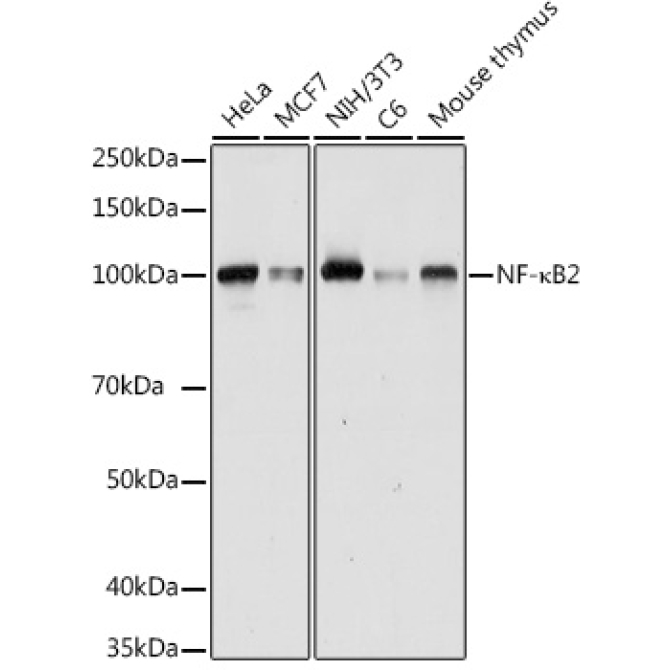 NF-?B2 Rabbit Polyclonal Antibody