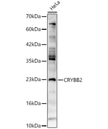 CRYBB2 Rabbit Polyclonal Antibody