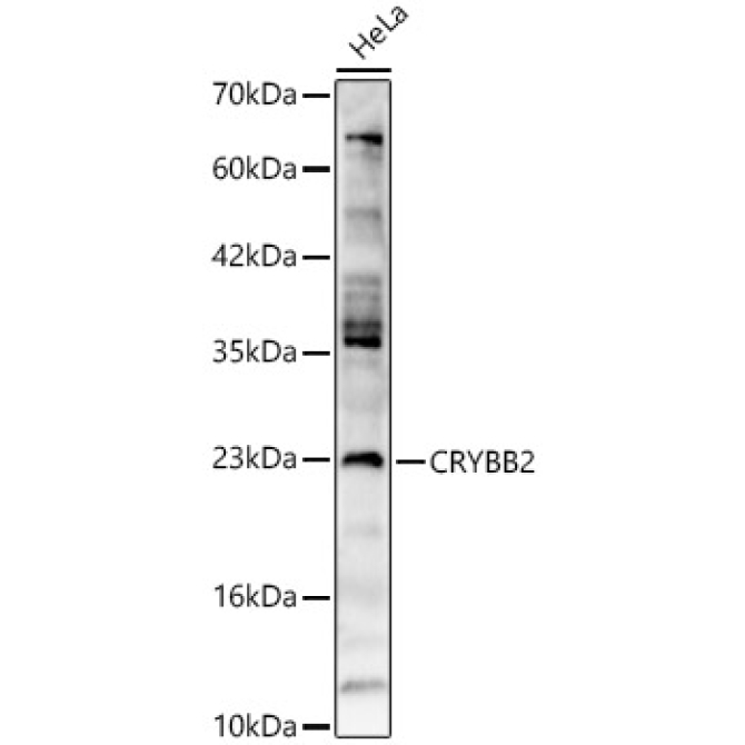 CRYBB2 Rabbit Polyclonal Antibody