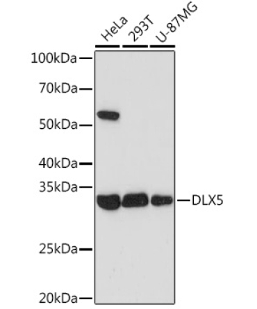 DLX5 Rabbit Monoclonal Antibody