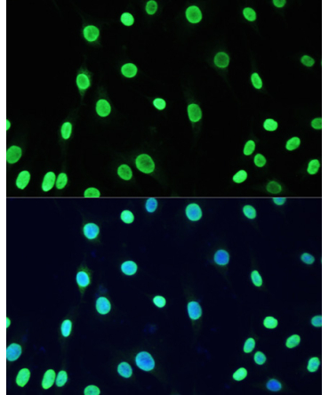 Acetyl-DNMT1-K1127/K1129/K1131/K1133 Rabbit Polyclonal Antibody