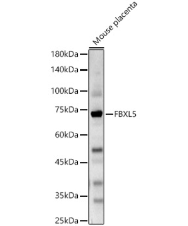 FBXL5 Rabbit Polyclonal Antibody