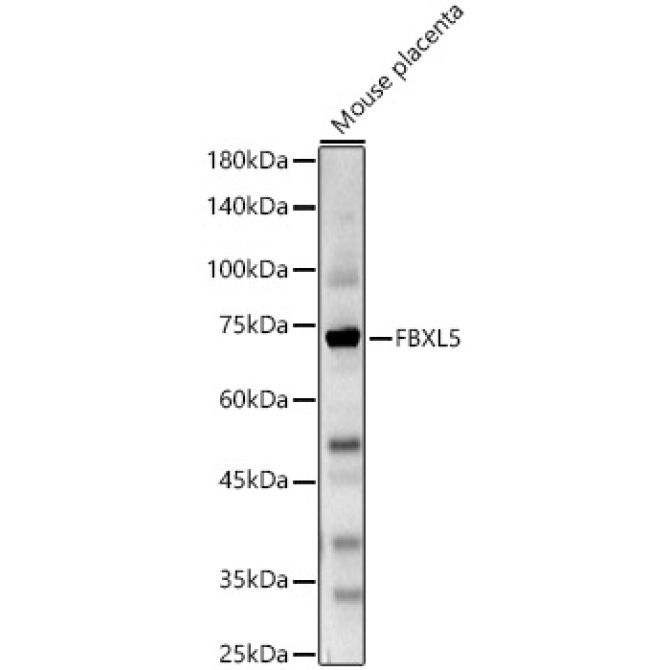 FBXL5 Rabbit Polyclonal Antibody