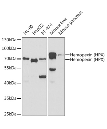 Hemopexin (HPX) Rabbit Polyclonal Antibody