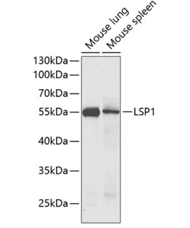 LSP1 Rabbit Polyclonal Antibody