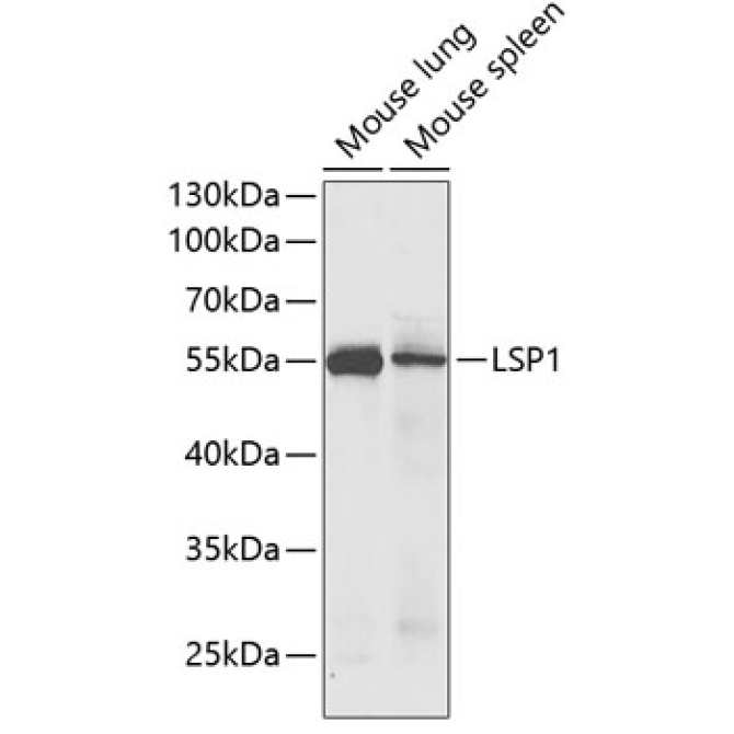 LSP1 Rabbit Polyclonal Antibody