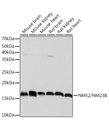 NME2/NM23B Rabbit Monoclonal Antibody