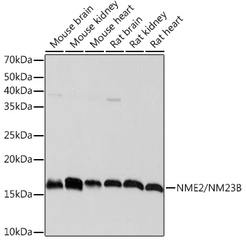 NME2/NM23B Rabbit Monoclonal Antibody
