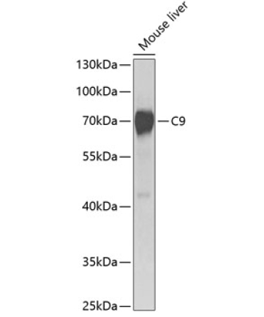 C9 Rabbit Polyclonal Antibody