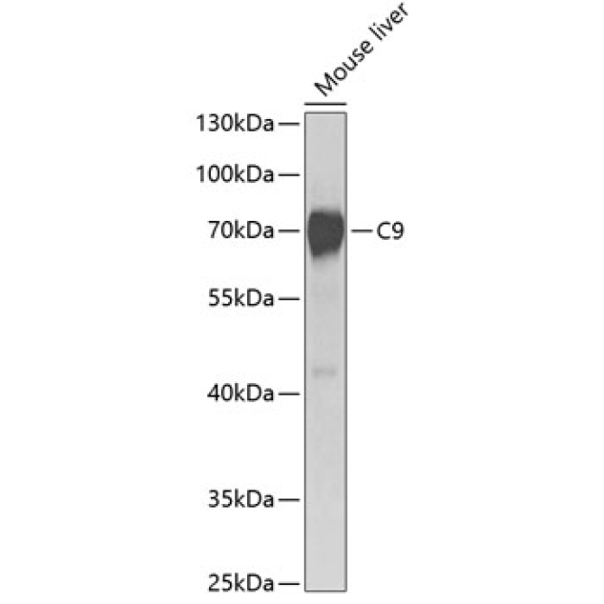 C9 Rabbit Polyclonal Antibody